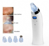 Blackhead removal/Acne removal pen